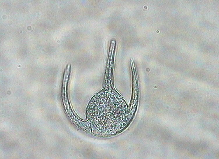 Dictyocha speculum